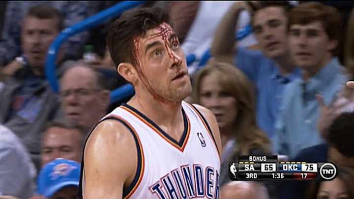 Thunder are auctioning off a pair of Nick Collison's blood-stained sneakers