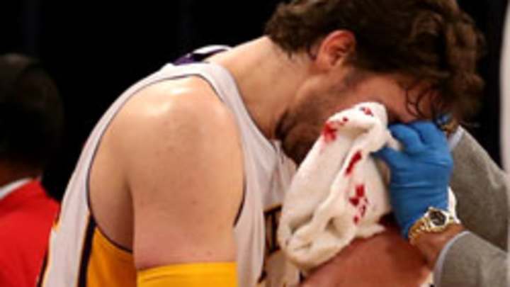 Dwight Howard, Pau Gasol, and Jordan Hill all injured for Lakers