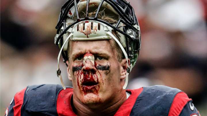 J.J. Watt's Mom Wants Him to Get Plastic Surgery