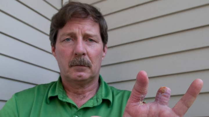 Golfer Fights Crocodile, Loses Two Fingers, Sues Course