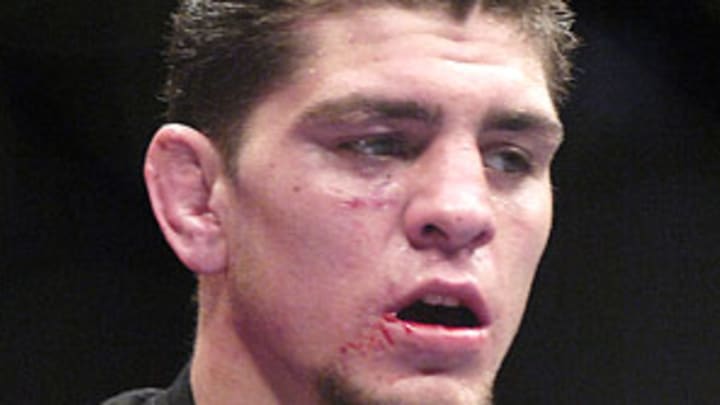 Elite XC pushing for Diaz-Noons showdown on October card Elite XC pushing for Diaz-Noons showdown on October card