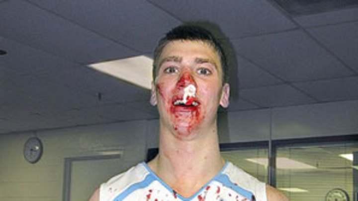 Referee czar attempting to clean up rough play in college hoops