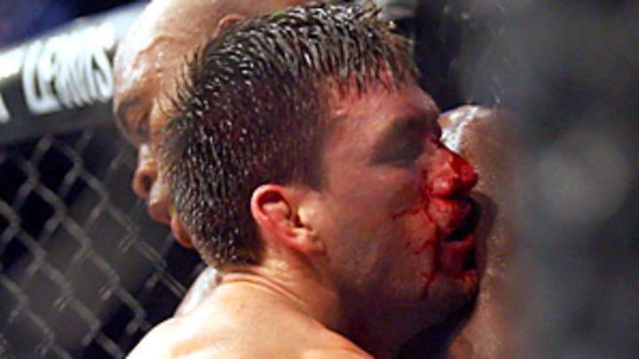 Megastars Penn, Silva fail to shine in UFC's Middle Eastern debut Megastars Penn, Silva fail to shine in UFC's Middle Eastern debut