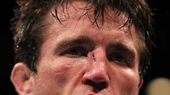 Jones-Sonnen not popular in MMA circles, Silva soars, more mail