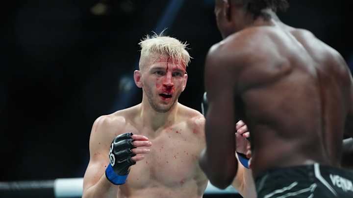 Dan Hooker Posts X-ray of Broken Arm After UFC 290 Victory Dan Hooker Posts X-ray of Broken Arm After UFC 290 Victory