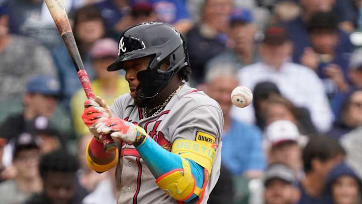 BREAKING: Ronald Acuña Jr leaves game after getting hit by pitch in elbow