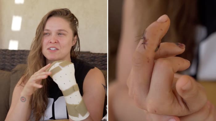 ronda-rousey-finger-injury-video.jpg