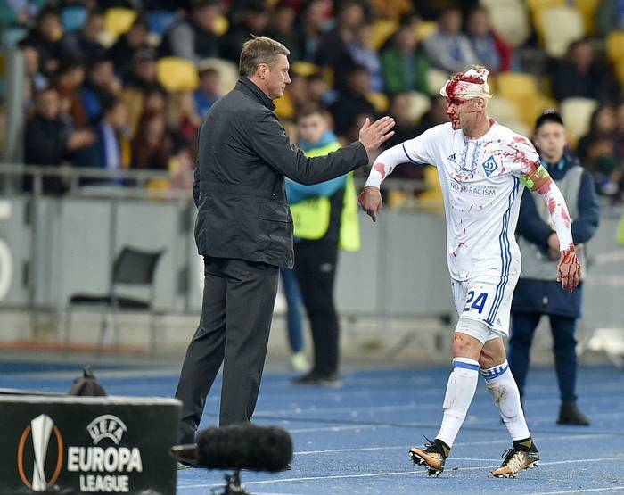 Dynamo Kiev Defender Domagoj Vida Suffers Brutal Head Injury During ...