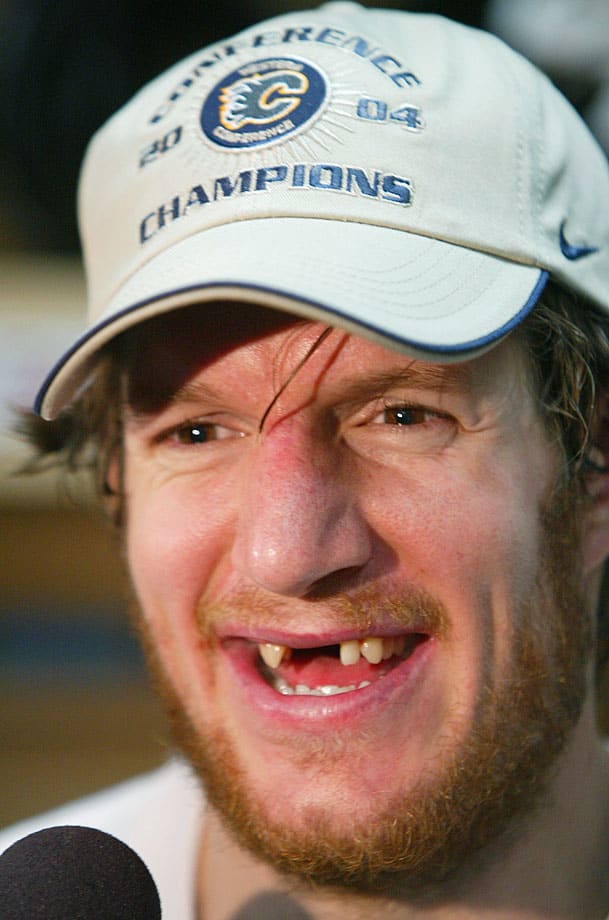 Hot Clicks Hockey's AllTime Best Toothless Smiles Sports Illustrated