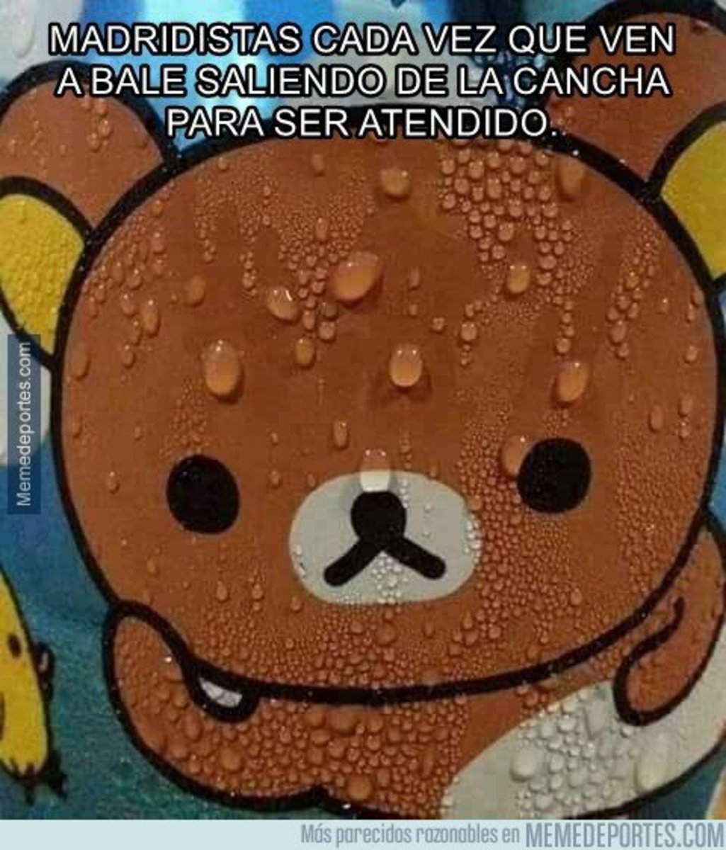 1060539 - Cada vez que Bale cojea, un madridista sufre taquicardia