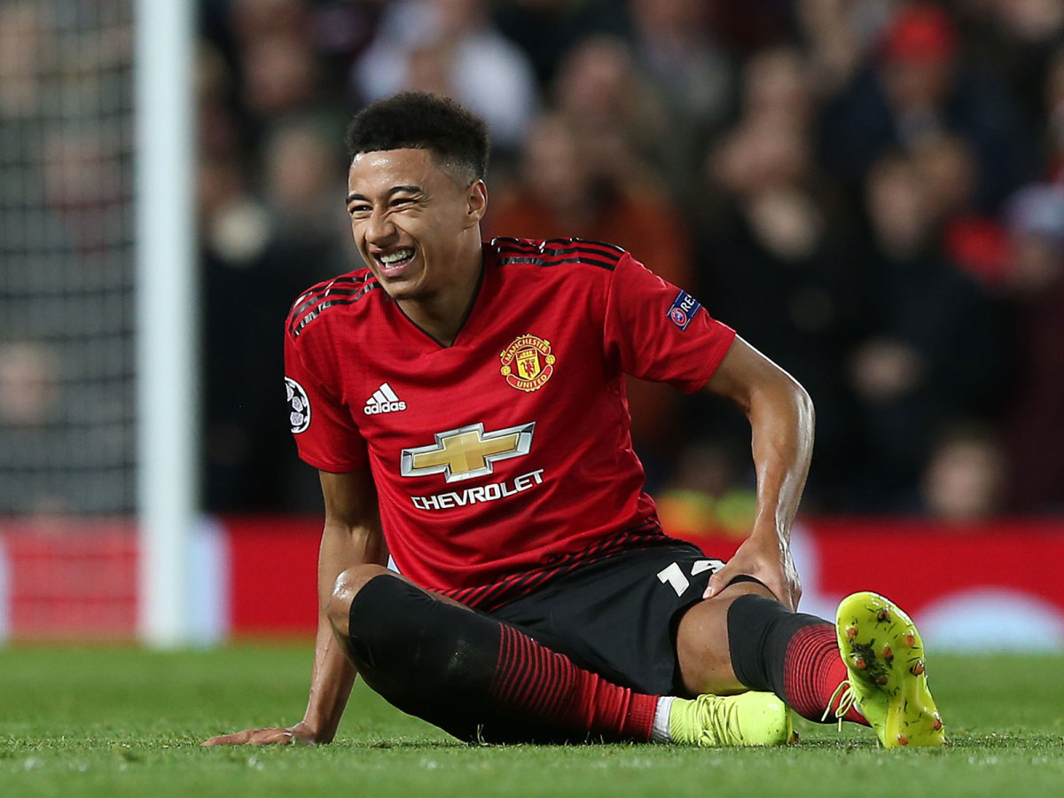 jesse-lingard-injury-man-united.jpg