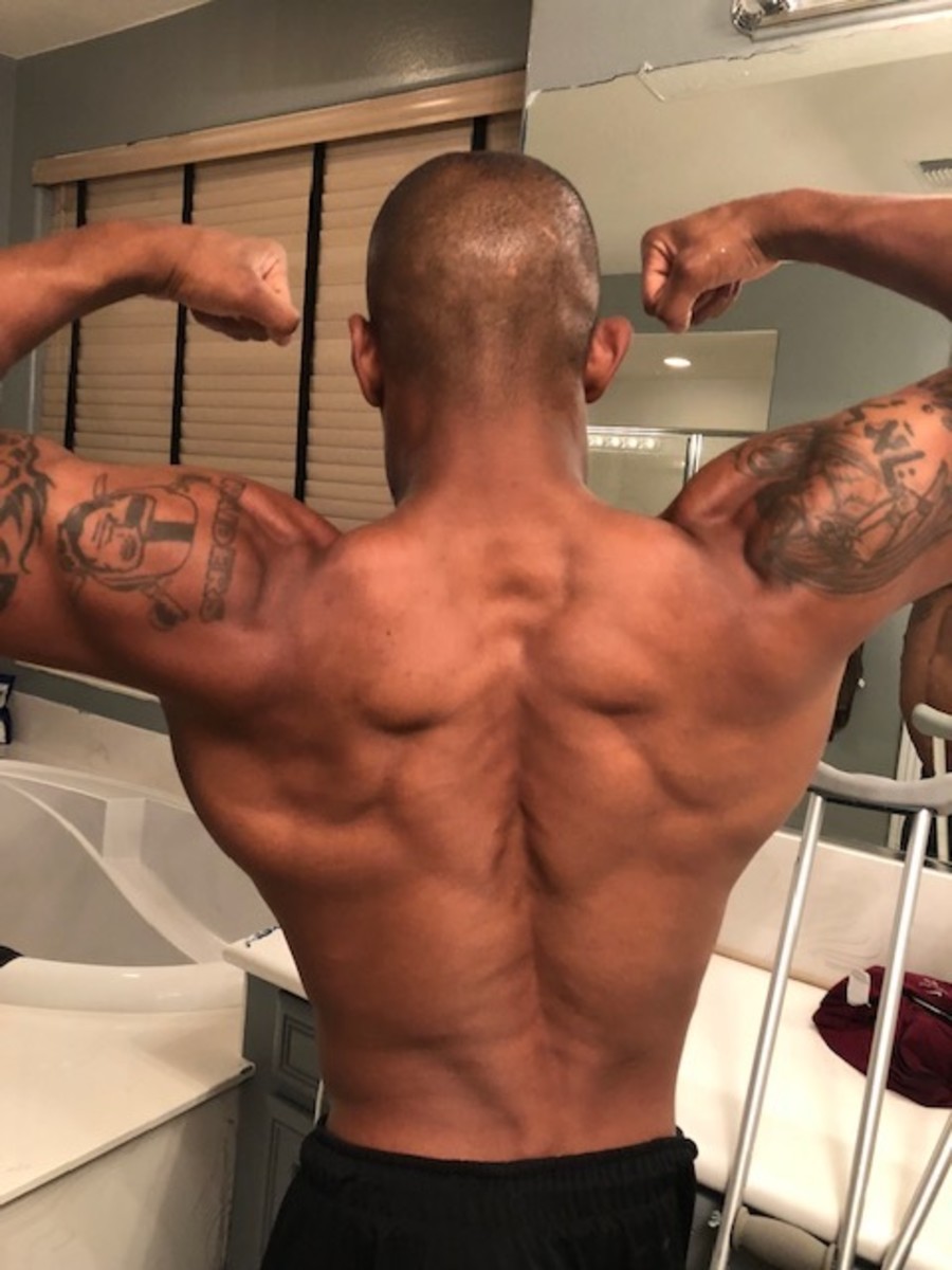 Anthony Robles attempts most pull ups in 24 hours