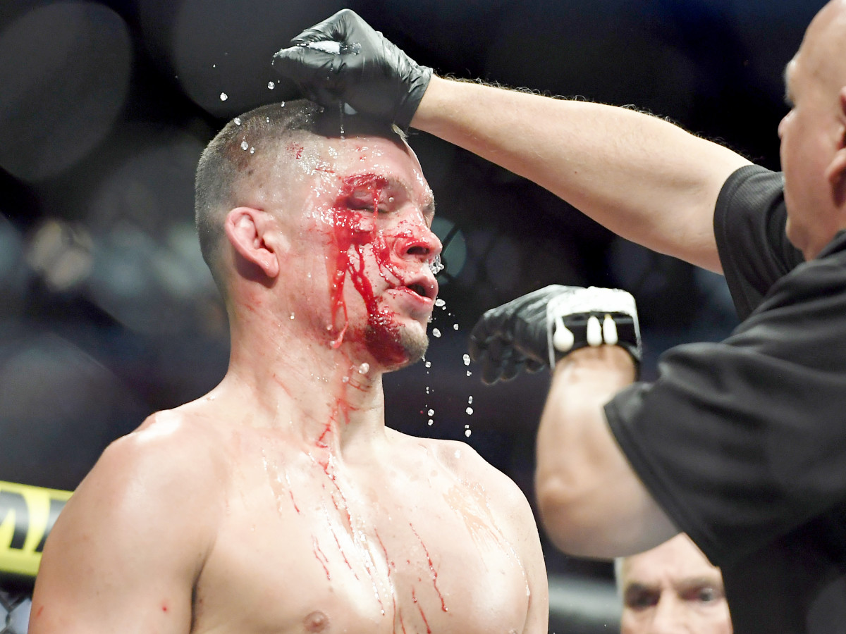 Nov 2, 2019; New York, NY, USA; Nate Diaz (blue gloves) gets treatment during his fight against Jorge Masvidal (red gloves) during UFC 244 at Madison Square Garden. Mandatory Credit: Sarah Stier-USA TODAY Sports