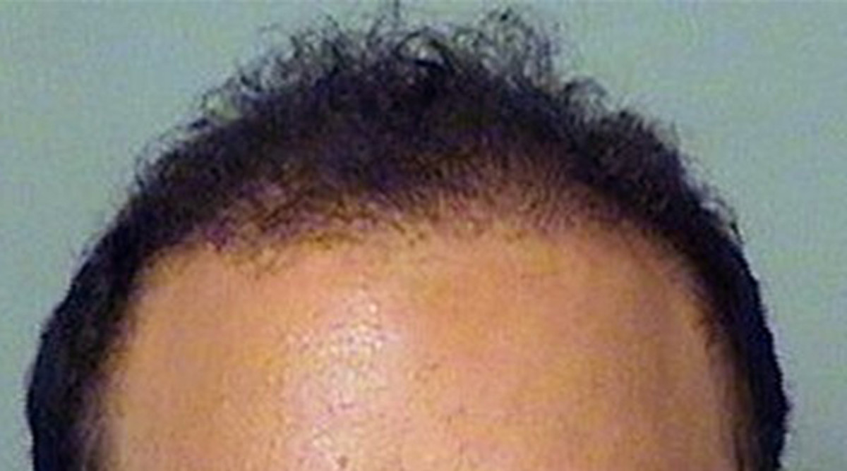 tiger-woods-hair.jpg