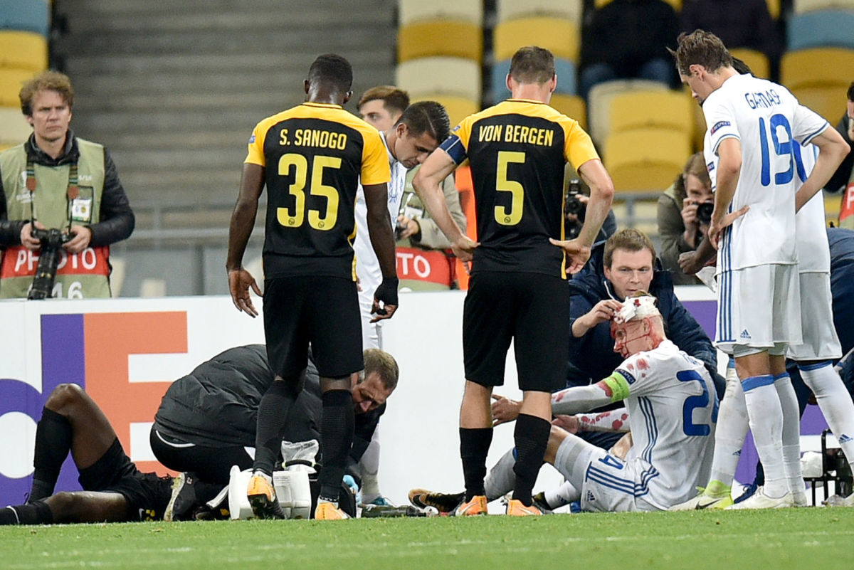 Dynamo Kiev Defender Domagoj Vida Suffers Brutal Head Injury