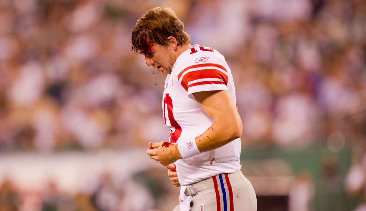A bloodied Eli would sit out—but hardly sit still for—the next preseason game.