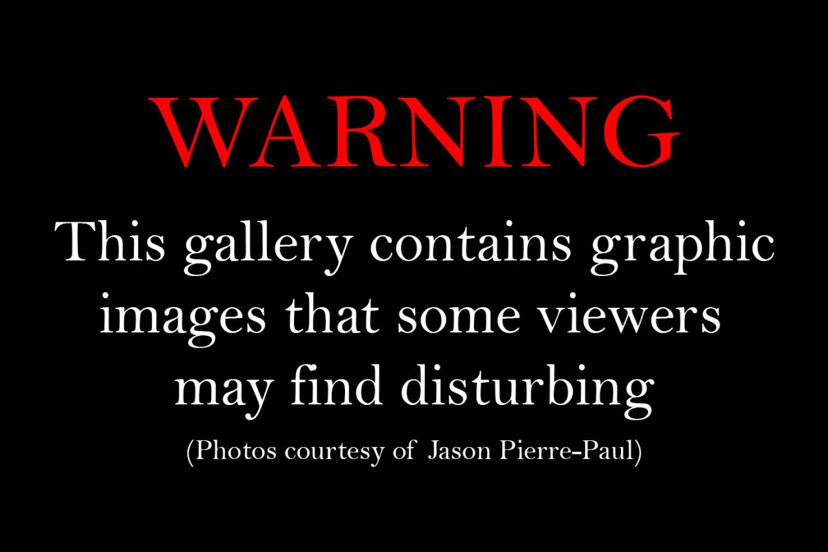 WARNING-graphic-images.jpg