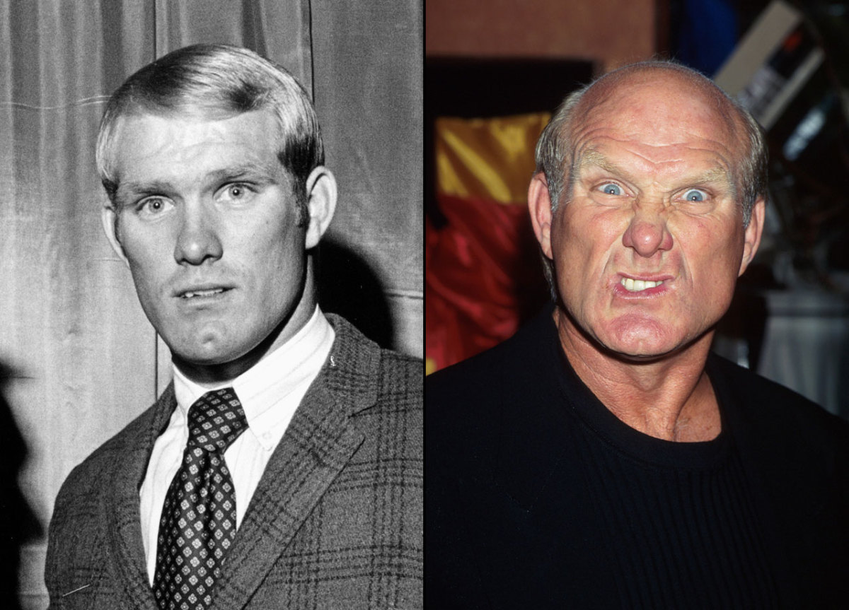 Terry-Bradshaw-hair.jpg