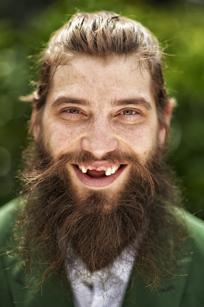 How Did Brent Burns Lose His Teeth?