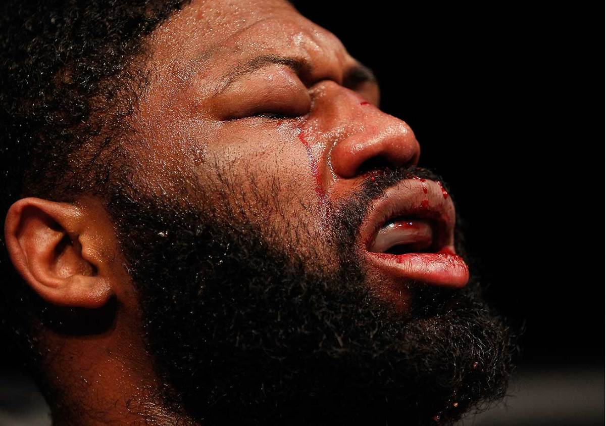 Curtis Blaydes swollen eye.jpg