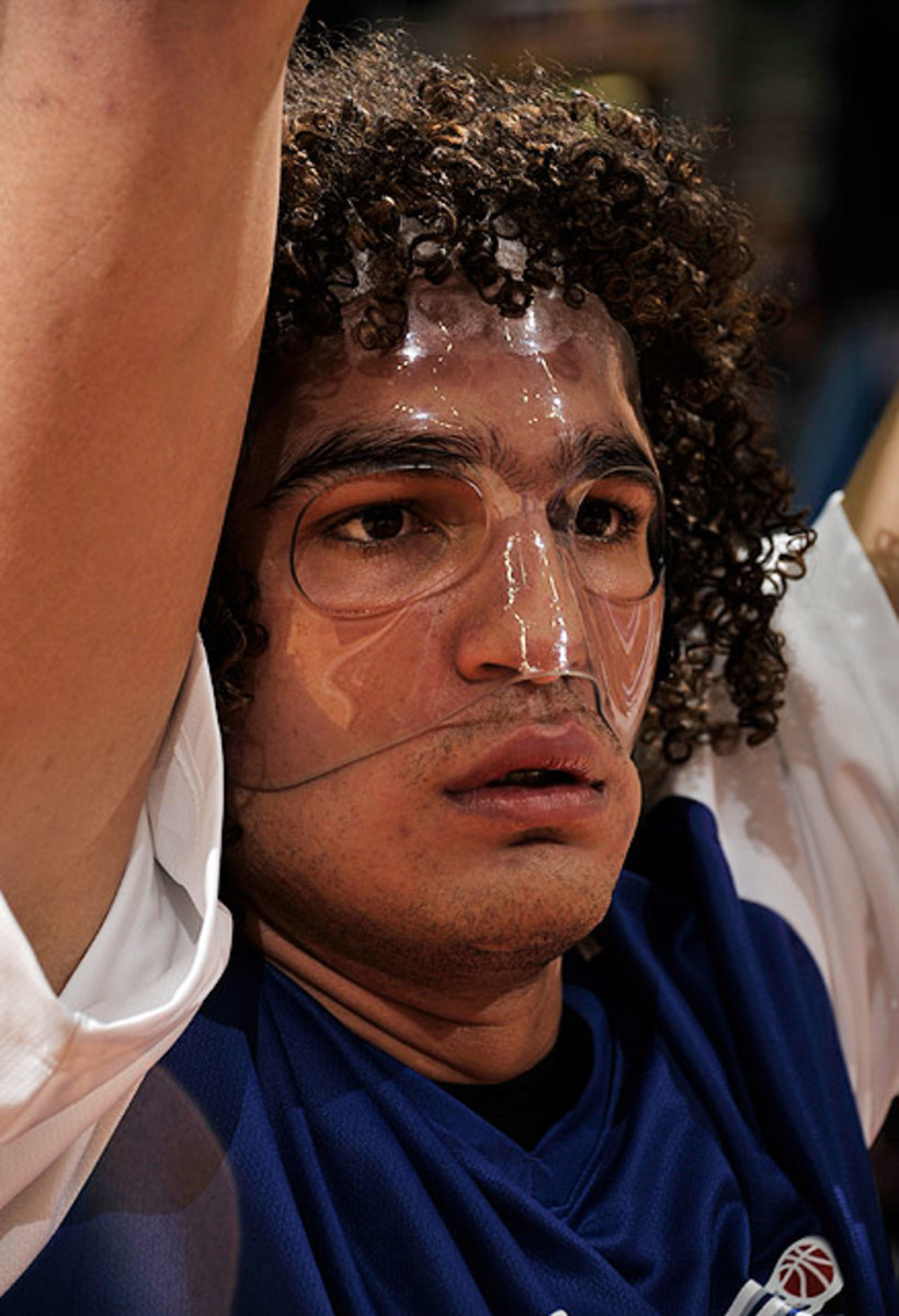 Anderson Varejao