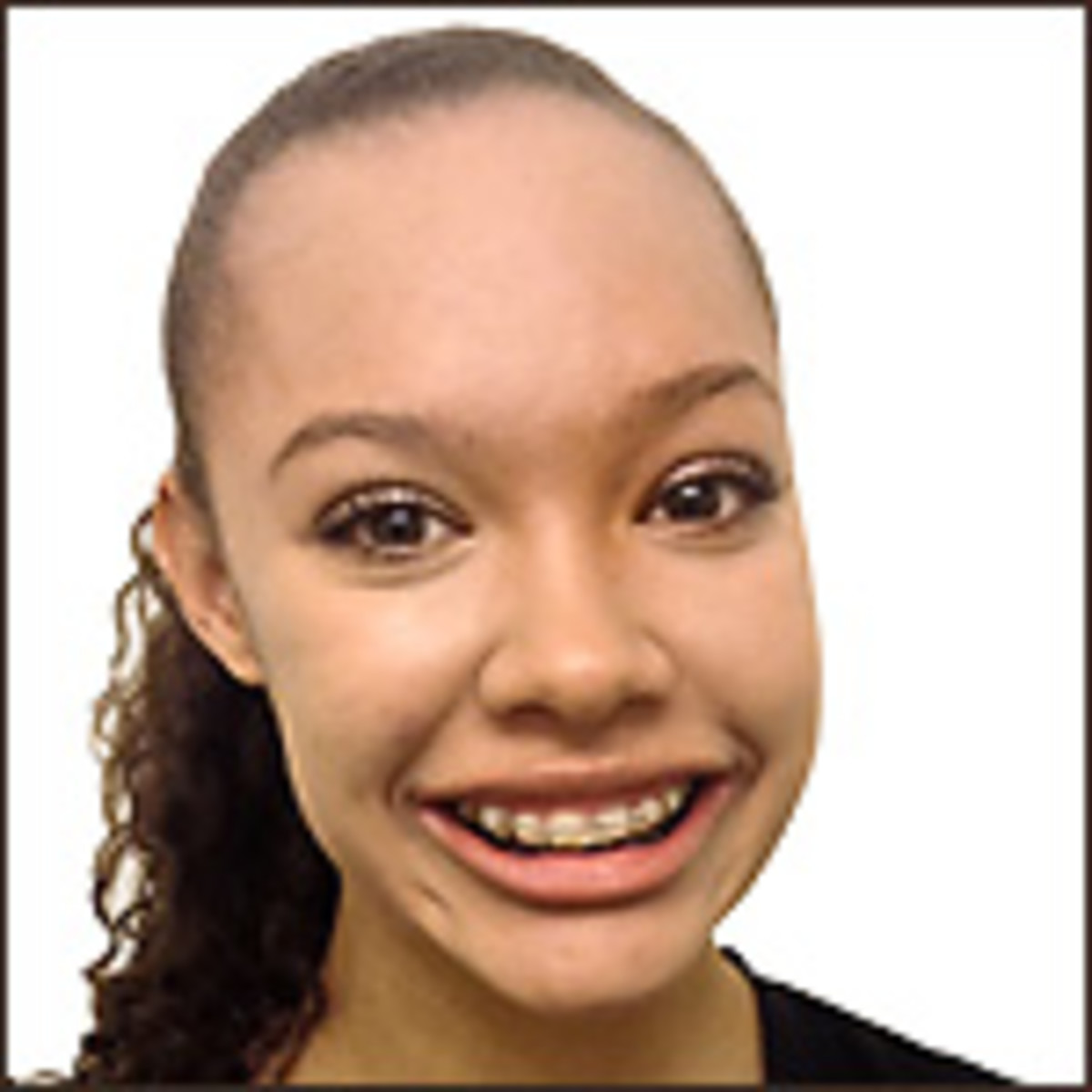 Image placeholder title