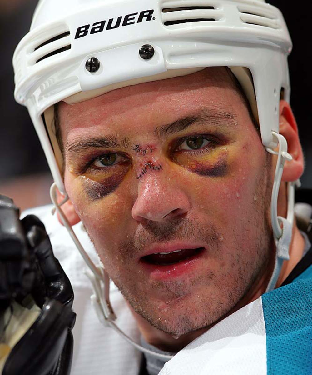 NHL's Faces of Battle - Sports Illustrated