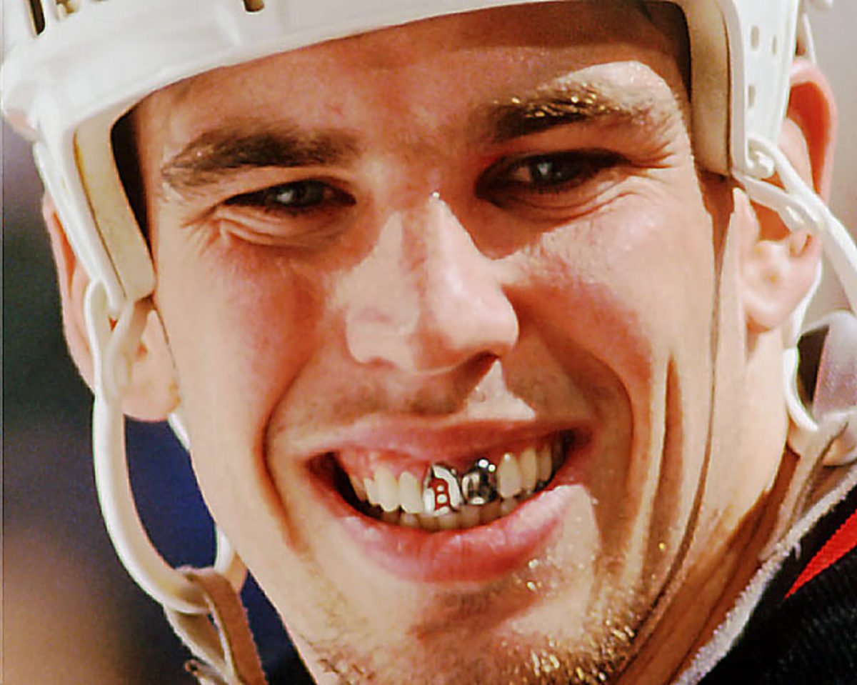 Овечкин без зуба. Мэттью Барнаби. Овечкин хоккеист зубы. Овечкин улыбка.