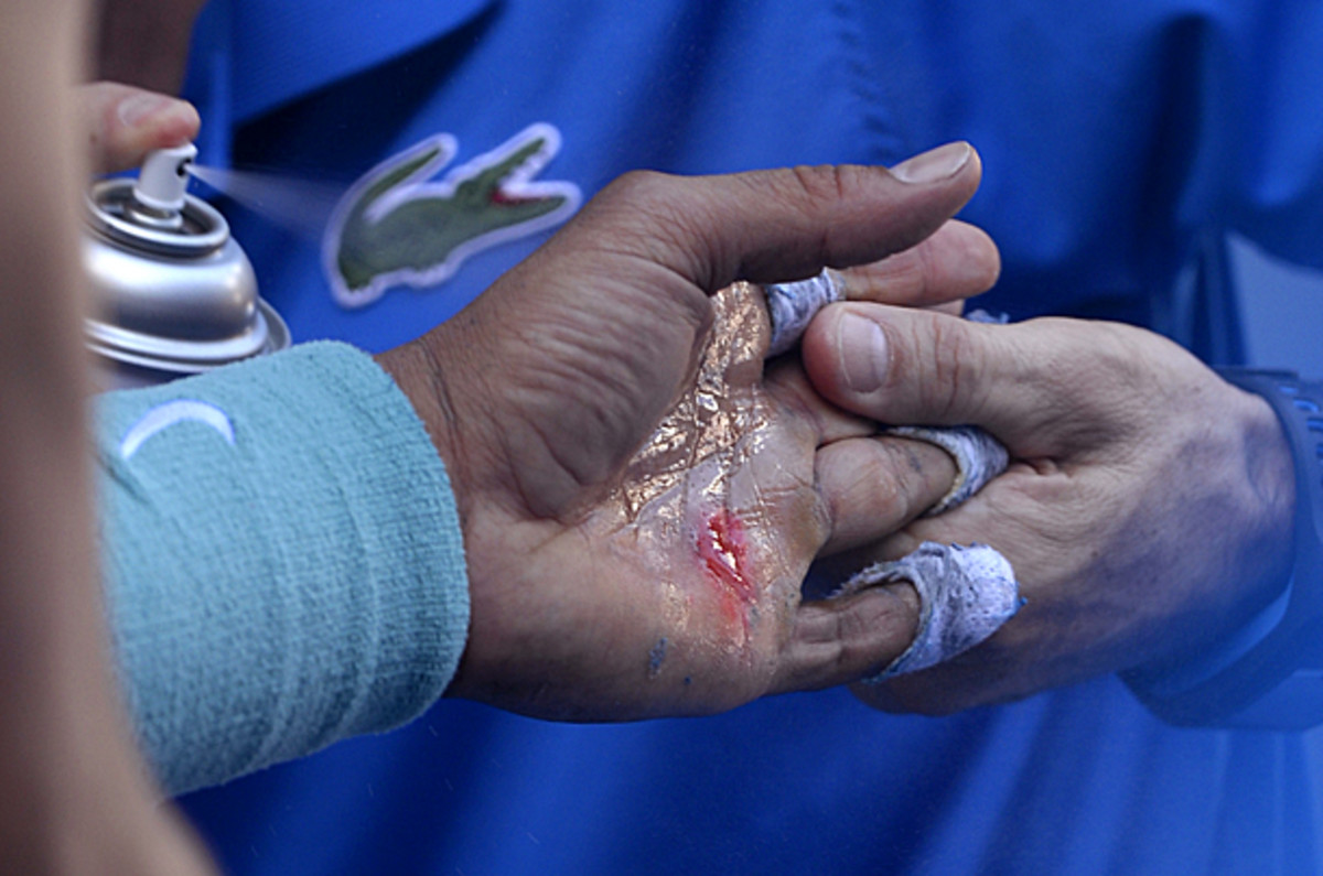 Rafael Nadal 's broken blister. (Andrew Brownbill/AP)