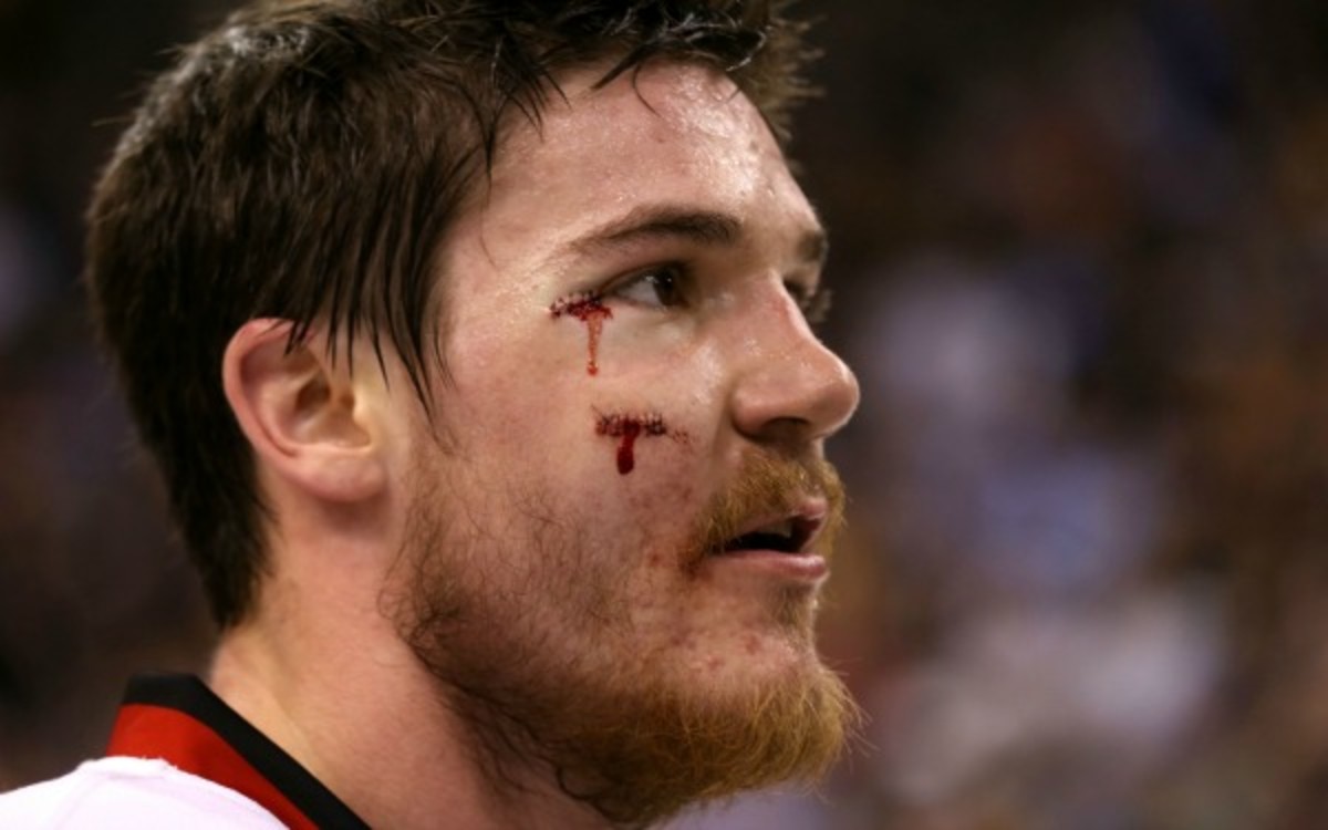 After more than two weeks out, Andrew Shaw is eyeing a Saturday return. (Bruce Bennett/Getty Images)