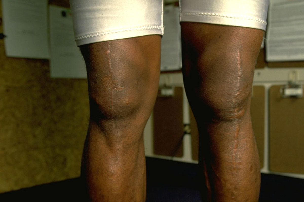 turf-wendell-davis-knees.jpg