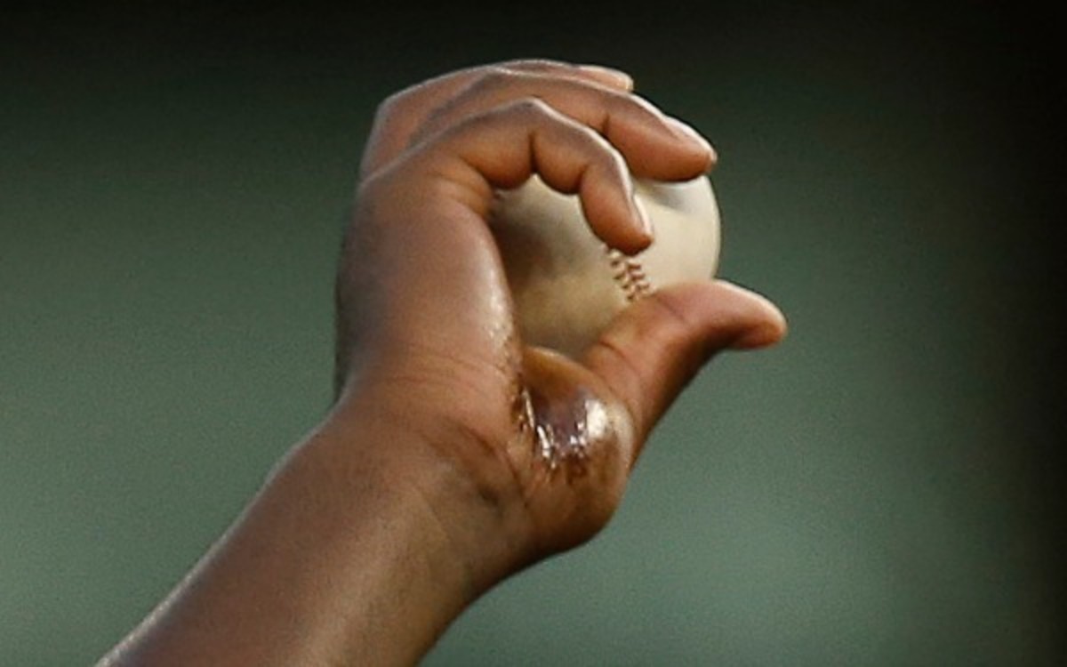 Yankees  pitcher Michael Pineda had a dark substance on his palm during last night's game. (AP Photo/Kathy Willens)