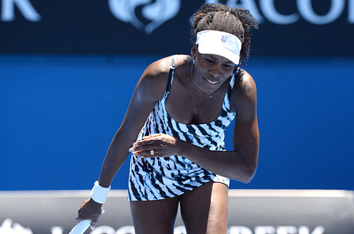 A leg injury to Venus Williams has forced her and sister Serena out of the Aussie Open doubles tournament. (MAL FAIRCLOUGH/AFP/Getty Images)