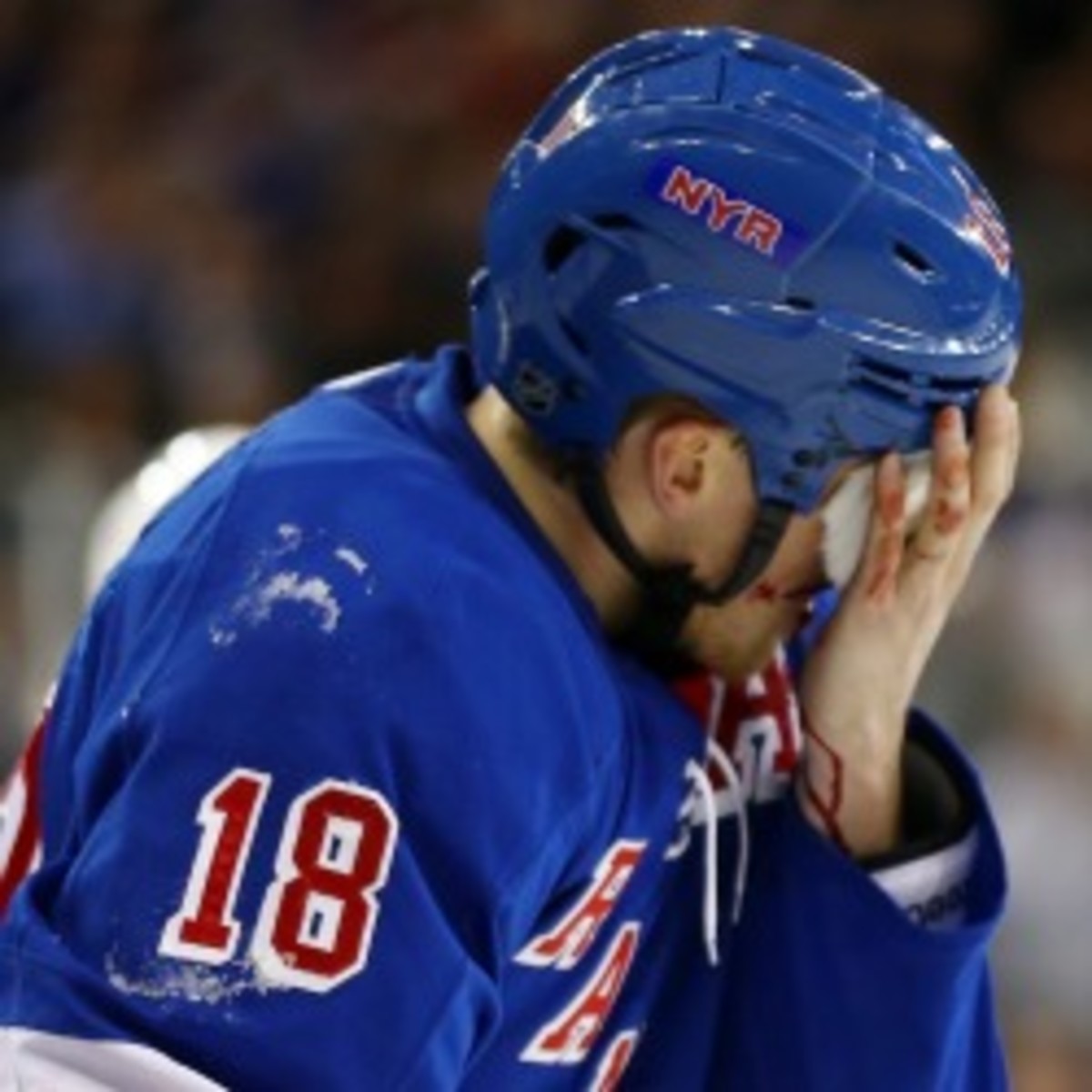 Rangers defenseman Marc Stall should make a full recovery after being hit in the eye with a puck. (Elsa/Getty Images)
