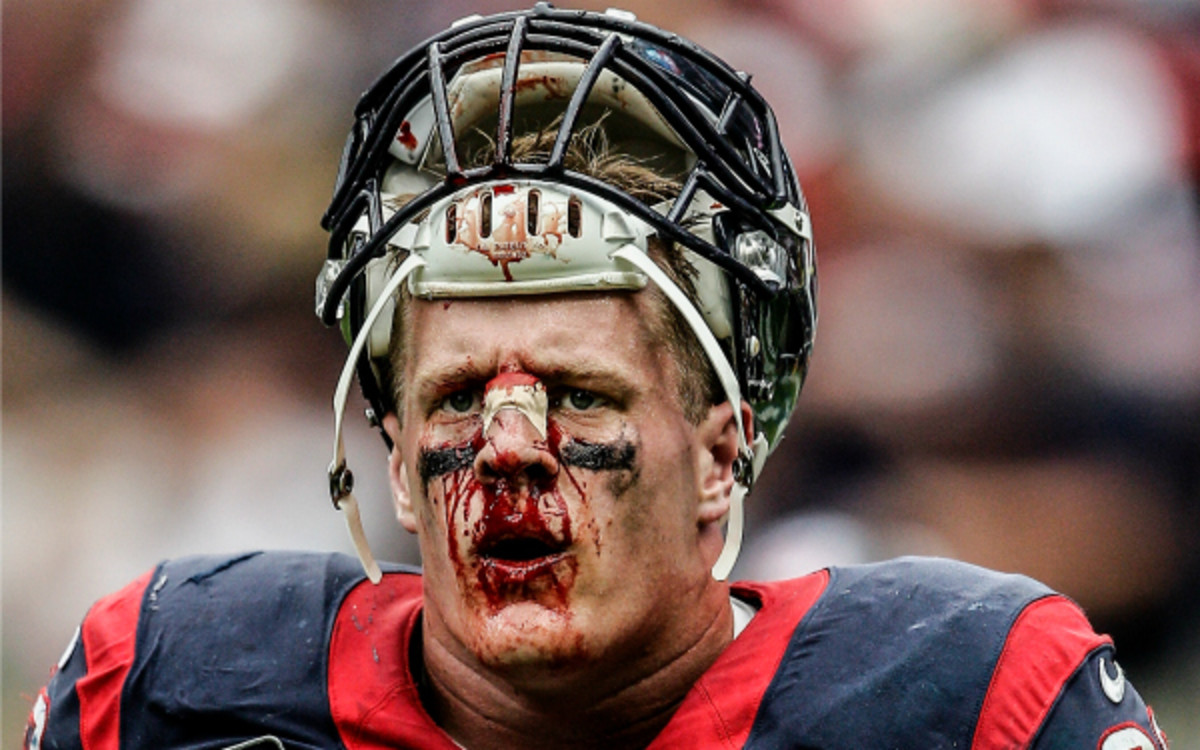 This is what happens if you don't listen to your mother. (Bob Levey/Getty Images)