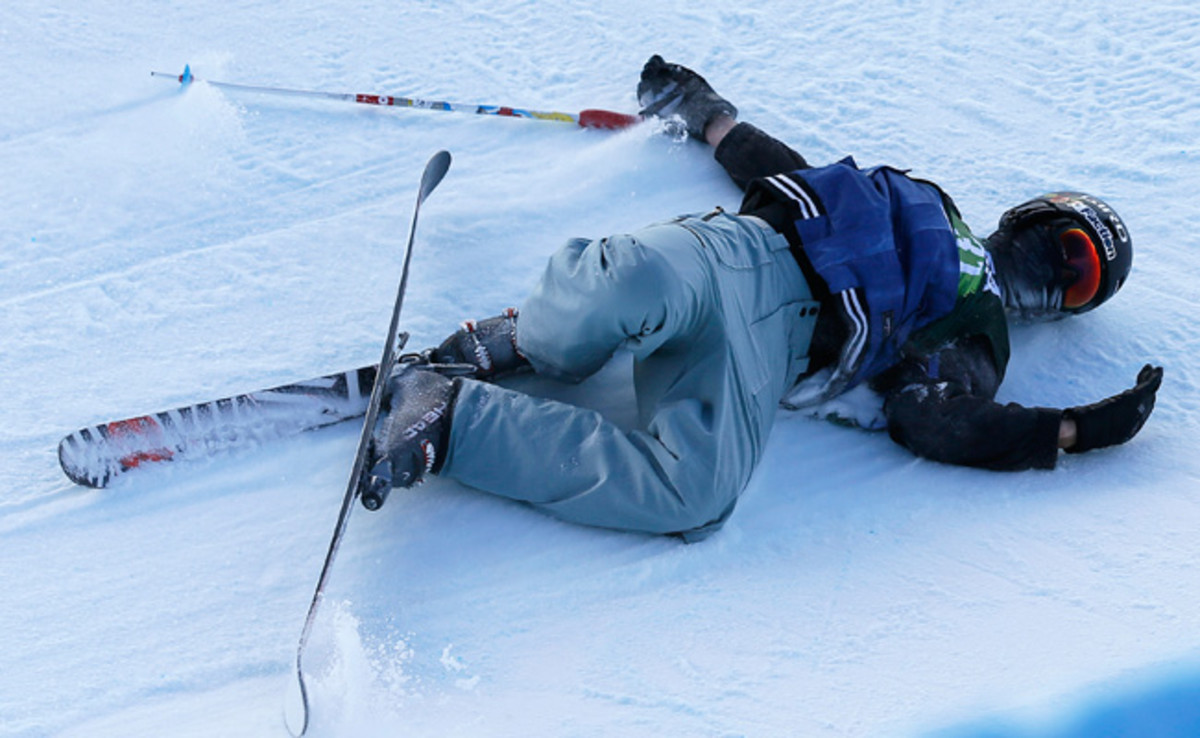 Simon D'Artois fell near the top of the 22-foot superpipe and slid to the bottom unconscious.