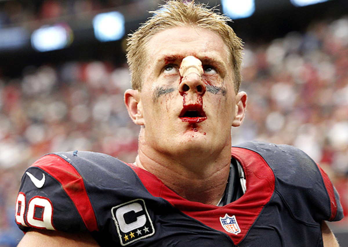 J.J. Watt finished the game with eight tackles, a half-sack and an epic wound. 