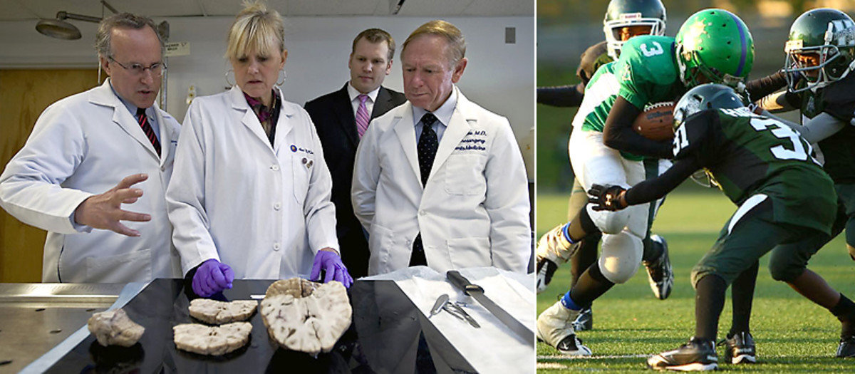 Doctors at the Bedford Veterans Administration Medical Center, repository for the Brain Bank, are studying the brain to gather more information that will enable youth programs like the Harlem Jets to play safely.