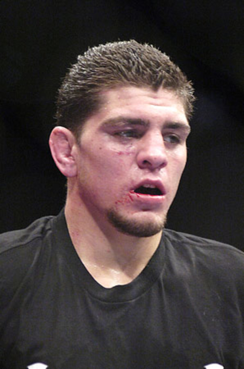 nickdiaz.jpg