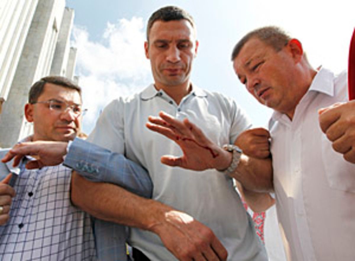 Klitschko, heavyweight boxing champion and leader of Ukrainian political party UDAR, looks at blood on his hand as he walks away after police fired teargas during a rally in Kiev
