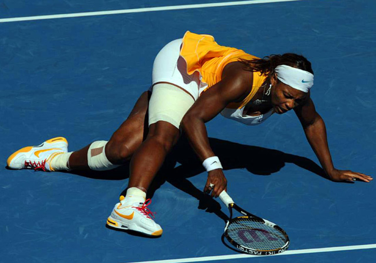 Serena Williams' right leg