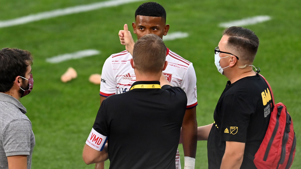 MLS is trialing a concussion substitution rule