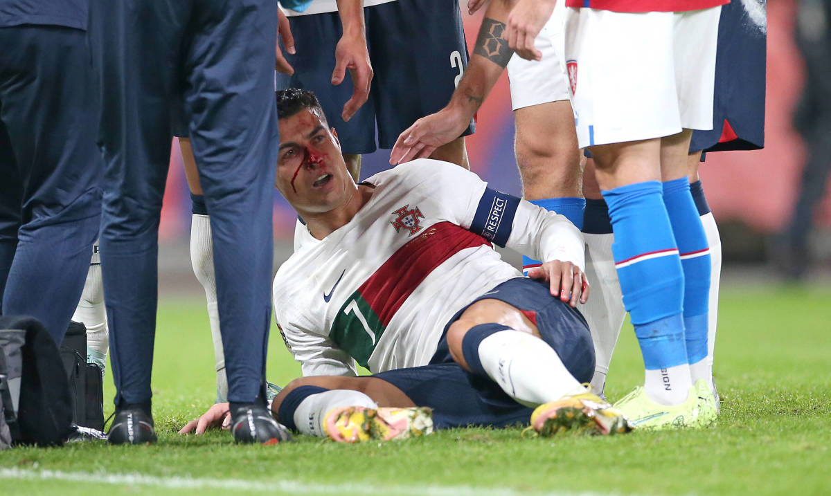 Cristiano Ronaldo pictured with blood on his face during Portugal's Nations League game with Czech Republic in September 2022