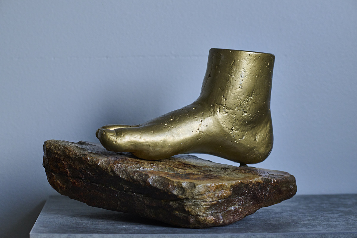 Before Thomas lost his leg, an uncle took a plaster casting of his about-to-be-amputated foot.