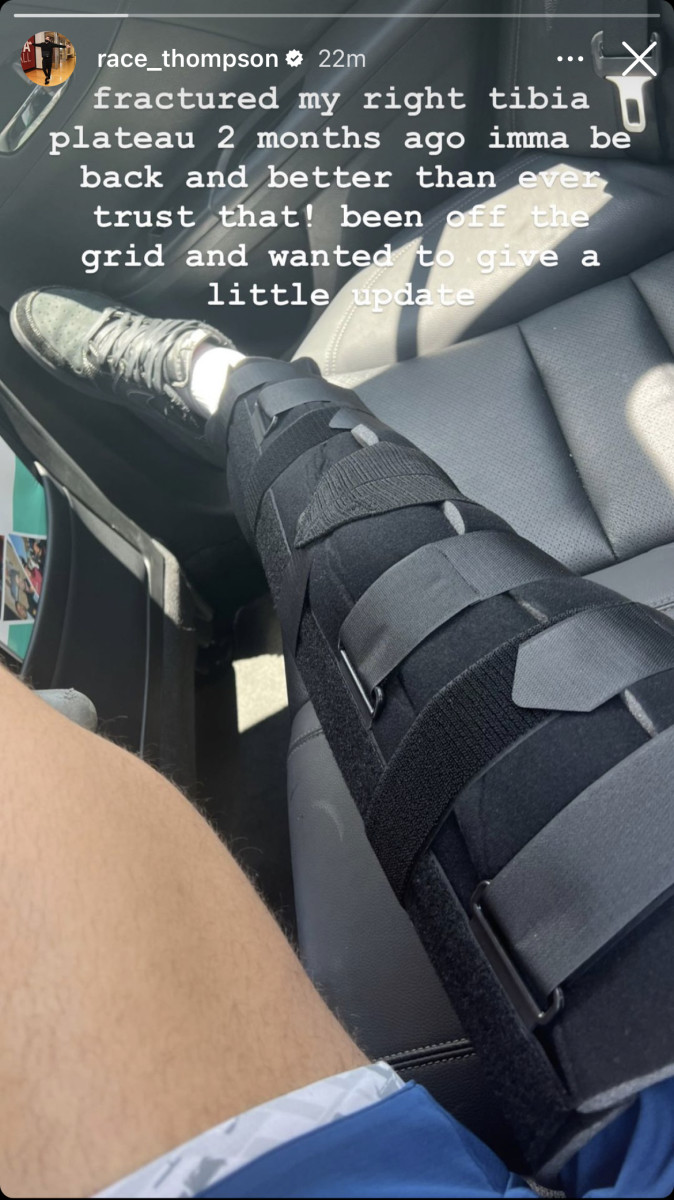 Race Thompson shared via Instagram on Tuesday that he fractured his right tibia plateau two months ago.