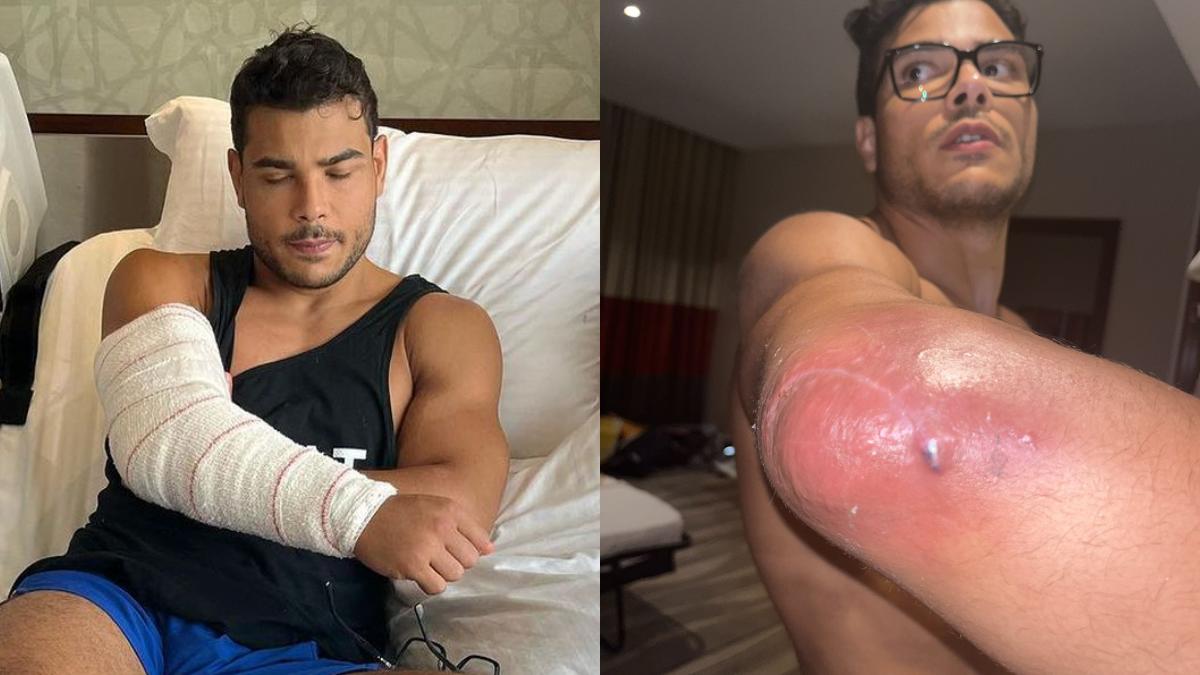 paulo-costa-explains-his-fight-threatening-surgery--his-attempt-to-hide-it-from-the-ufc.png