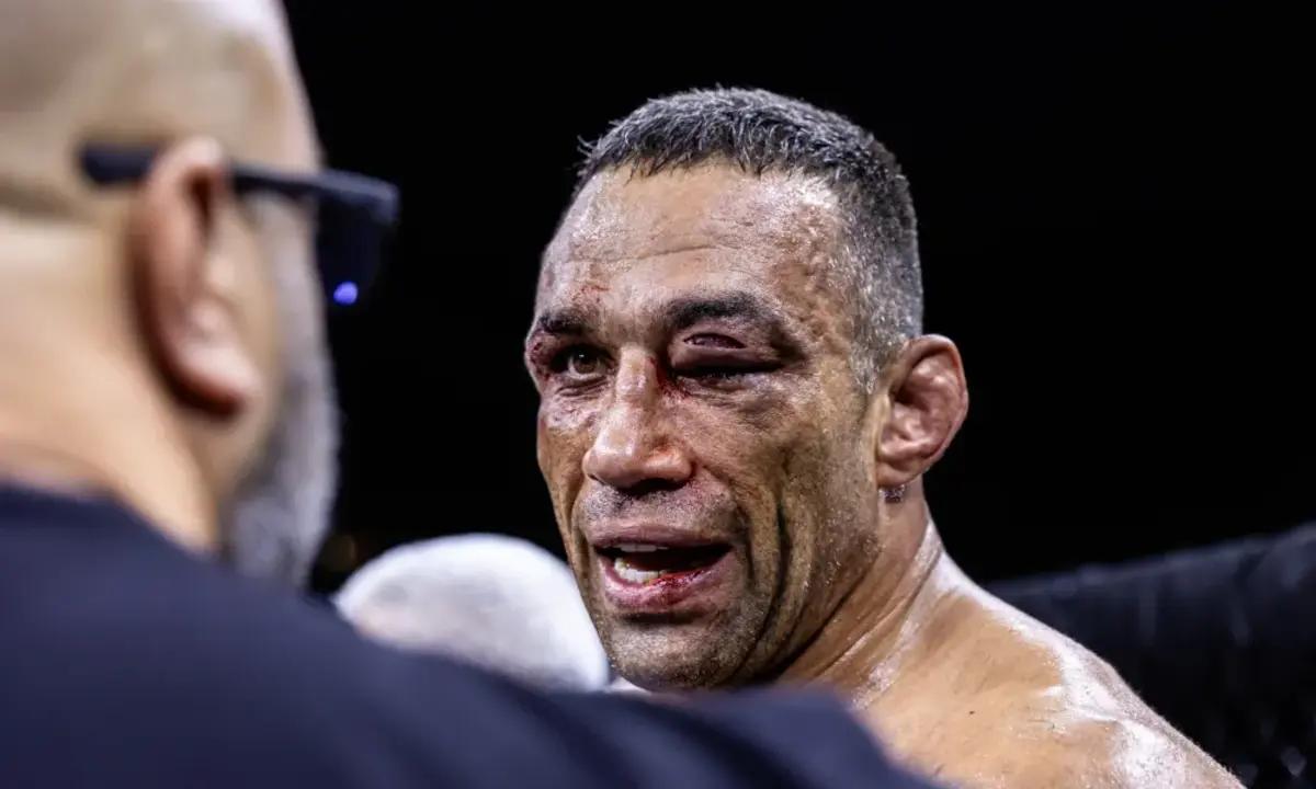 Fabricio Werdum's face after fighting JDS, Photo courtesy of Gamebred Bareknuckle)